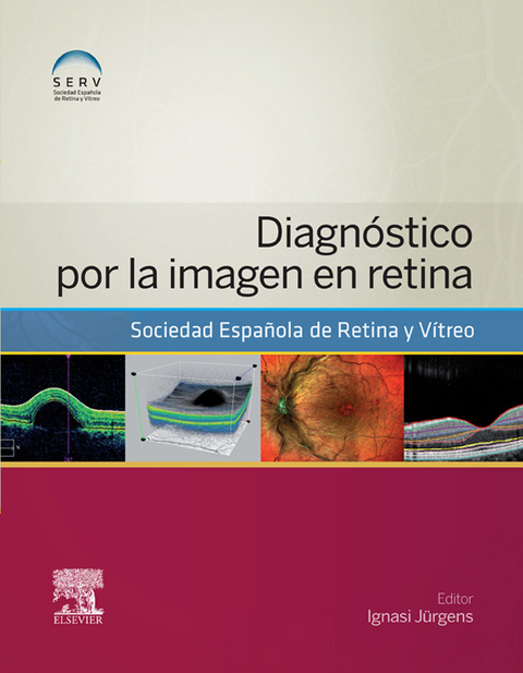 Diagnóstico por la imagen en retina -  Serv