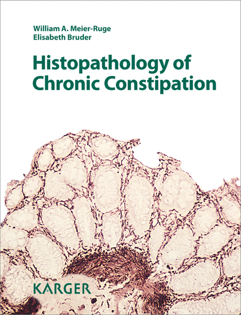 Histopathology of Chronic Constipation - W.A. Meier-Ruge, E. Bruder