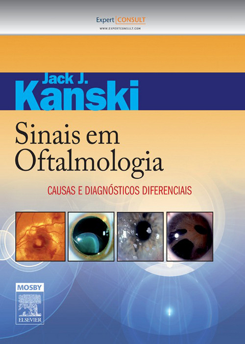 Sinais em Oftalmologia -  Jack J. Kanski