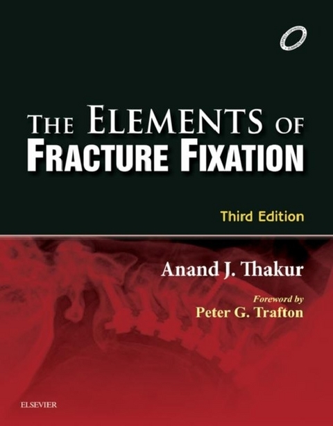 Elements of Fracture Fixation - E-book -  Anand J. Thakur