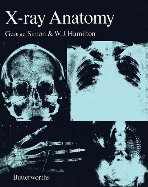 X-Ray Anatomy -  W. J. Hamilton,  George Simon