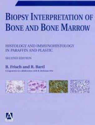 Biopsy Interpretation of Bone and Bone Marrow, 2Ed - Reiner Bartl, Bertha Frisch