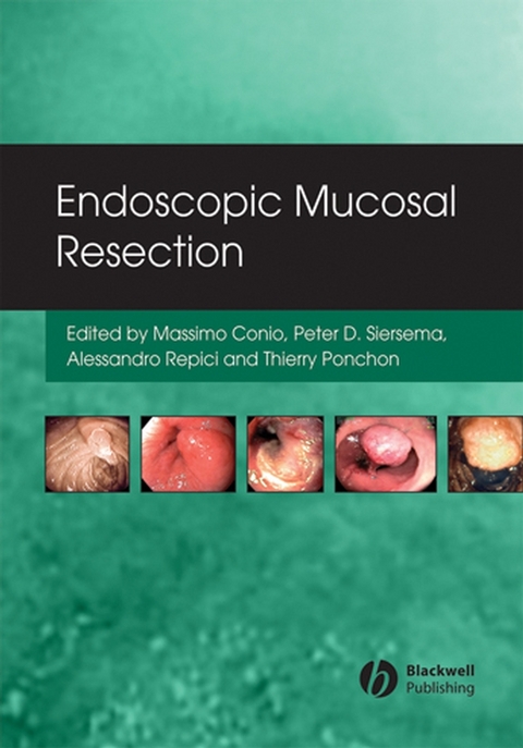 Endoscopic Mucosal Resection - 