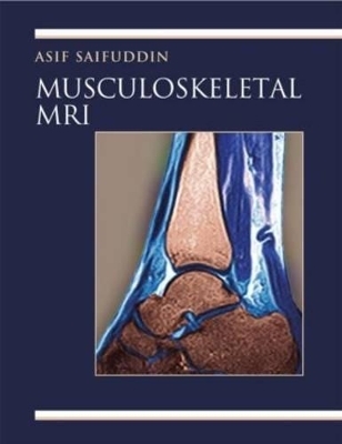 Musculoskeletal MRI - Asif Saifuddin