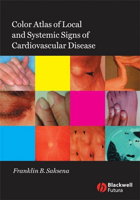 Color Atlas of Local and Systemic Manifestations of Cardiovascular Disease -  Franklin B. Saksena