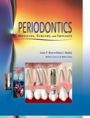 Periodontics - Louis F. Rose, Brian L. Mealey, Robert J. Genco, D.Walter Cohen