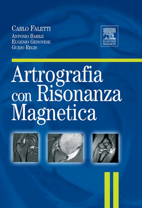 ARTROGRAFIA CON RISONANZA MAGNETICA -  C. Faletti,  A. Barile,  E. Genovese,  G. Regis