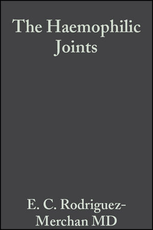 Haemophilic Joints - 