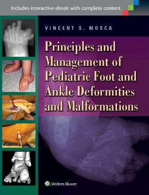 Foot and Deformities and Malformations in Children: A Principles-Based, Practical Guide to Assessment and Management - Dr. Vincent S Mosca