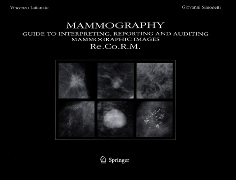 Mammography - V. Lattanzio, G. Simonetti