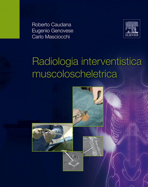 Radiologia interventistica muscoloscheletrica - 