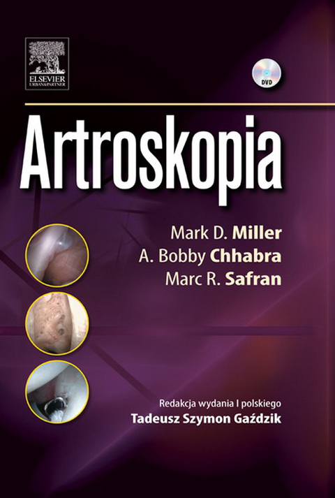 Artroskopia -  M. D. Miller