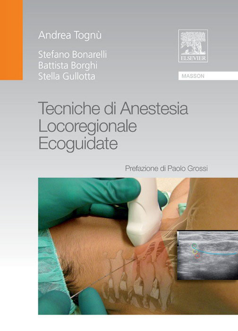 Tecniche di anestesia locoregionale ecoguidate -  B. Borghi,  A. Tognù,  S. Bonarelli,  S. Gullotta
