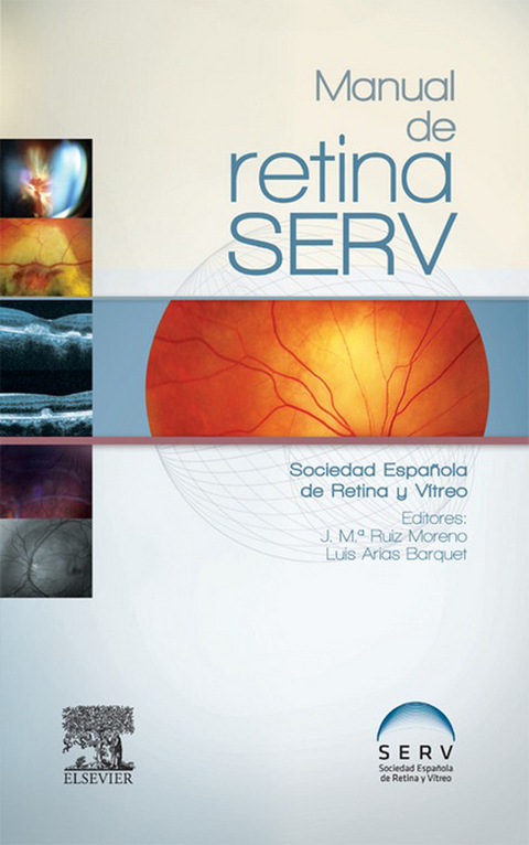 Manual de retina SERV - 