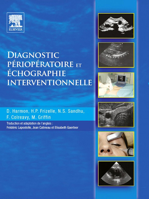 Diagnostic périopératoire et échographie interventionnelle -  Jean Catineau,  Frances Colreavy,  Henry P. Frizelle,  Elisabeth Gaertner,  Michael Griffin,  Dominic Harmon,  Frederic Lapostolle,  Navparkash S. Sandhu