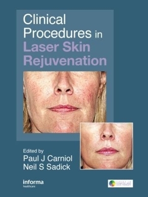 Clinical Procedures in Laser Skin Rejuvenation - 
