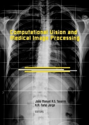 Computational Vision and Medical Image Processing - 