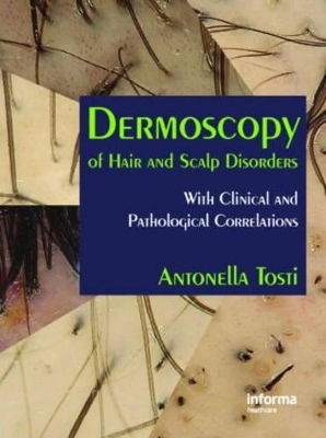 Dermoscopy of Hair and Scalp Disorders - Antonella Tosti