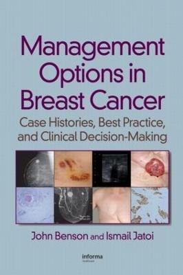 Management Options in Breast Cancer - John Benson, Ismail Jatoi