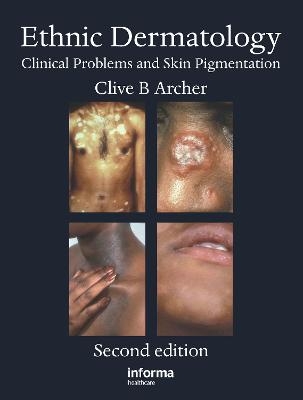 Ethnic Dermatology - 