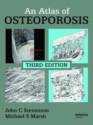 An Atlas of Osteoporosis - John C. Stevenson, Michael S. Marsh