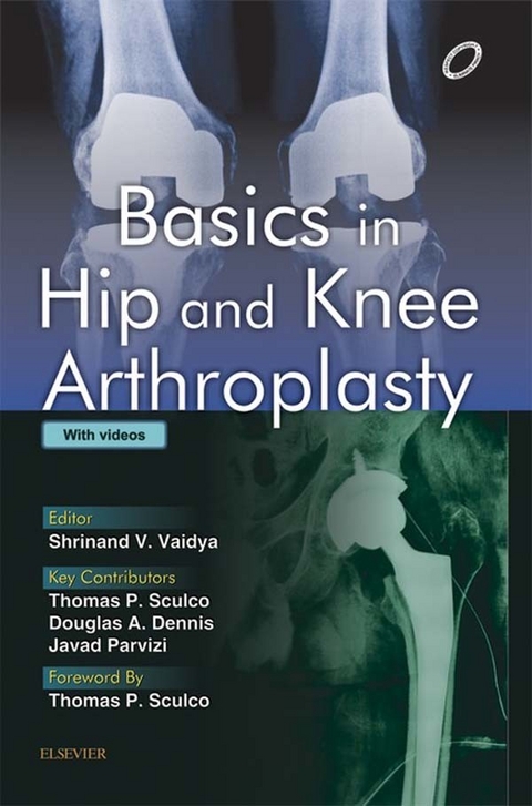 Basics in Hip and Knee Arthroplasty - E-book -  Shrinand Vaidya
