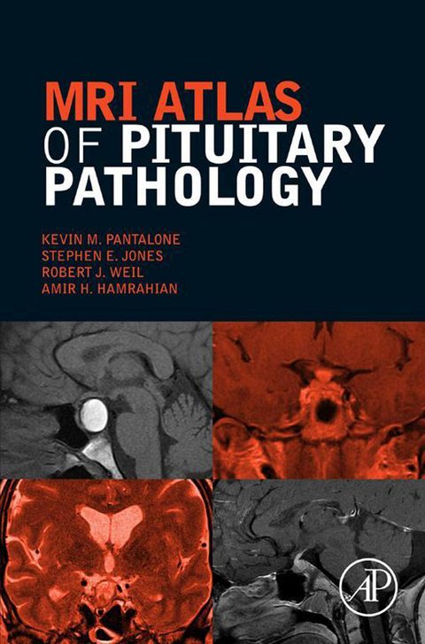 MRI Atlas of Pituitary Pathology -  Amir H. Hamrahian,  Stephen E. Jones,  Kevin M. Pantalone,  Robert J. Weil