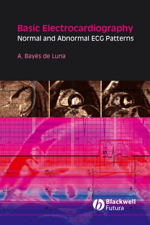 Basic Electrocardiography -  Antoni Bay s de Luna