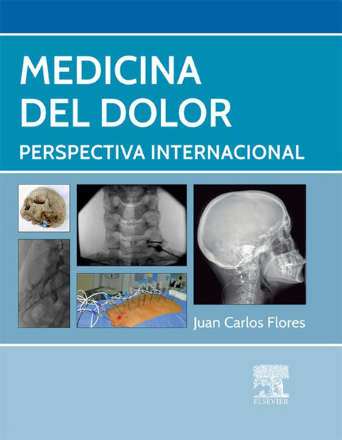 Medicina del dolor - 