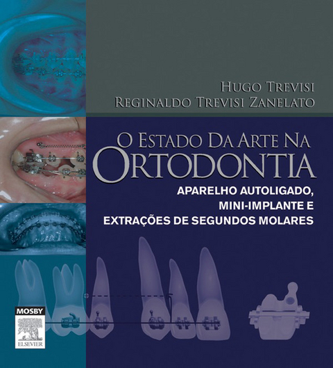 O Estado Da Arte Na Ortodontia -  Hugo Trevisi,  Reginaldo Trevisi ZANELATO