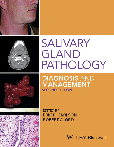 Salivary Gland Pathology -  Eric R. Carlson,  Robert A. Ord