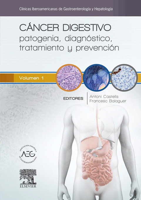 Cáncer digestivo: patogenia, diagnóstico, tratamiento y prevención - 