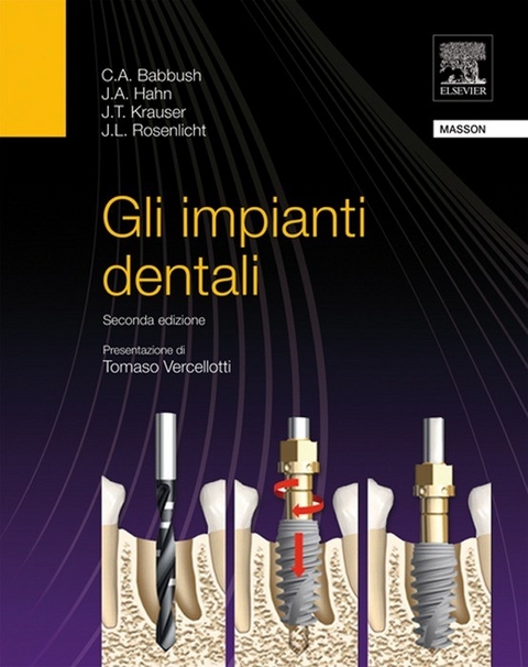 Gli impianti dentali -  C. A. Babbush,  J. A. Hahn,  J. L. Rosenlicht