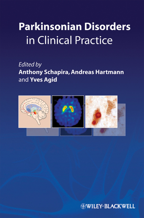 Parkinsonian Disorders in Clinical Practice - 