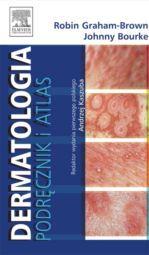 Dermatologia. Podrecznik i atlas -  Robin Graham-Brown