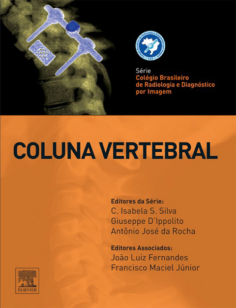 Coluna Vertebral -  João Luiz Fernandes,  Francisco Maciel Junior