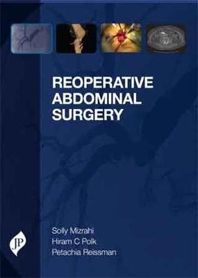 Reoperative Abdominal Surgery - Solly Mizrahi, Petachia Reissman, Hiram C Polk