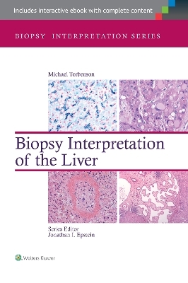 Biopsy Interpretation of the Liver - Michael Torbenson