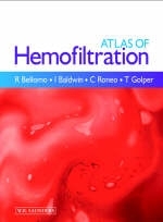 Hemofiltration in the ICU - Rinaldo Bellomo, Ian Baldwin, Claudio Ronco, Thomas Golper