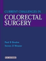 Current Challenges in Colorectal Surgery - Paul B. Boulos, Steven D. Wexner