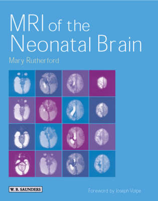MRI of the Neonatal Brain - Mary Rutherford