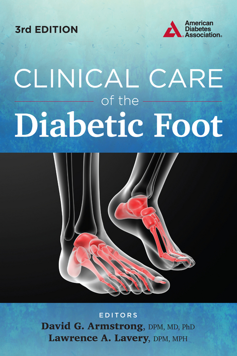 Clinical Care of the Diabetic Foot - 