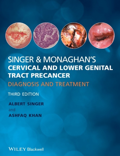 Singer and Monaghan's Cervical and Lower Genital Tract Precancer - Albert Singer, Ashfaq Khan