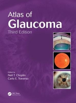 Atlas of Glaucoma - 