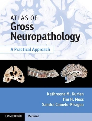 Atlas of Gross Neuropathology Book and Online Bundle - Kathreena M. Kurian, Tim H. Moss, Sandra Camelo-Piragua