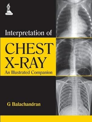 Interpretation of Chest X-Ray - G Balachandran
