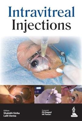 Intravitreal Injections - Shalabh Sinha, Lalit Verma