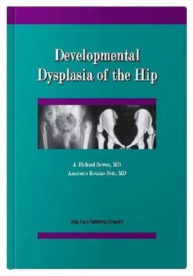 Developmental Dysplasia of the Hip - J. Richard Bowen, Anastacio Kotzias-Neto