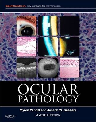 Ocular Pathology E-Book - Myron Yanoff, Joseph W Sassani