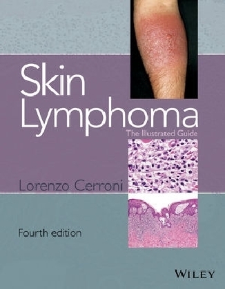 Skin Lymphoma - Lorenzo Cerroni